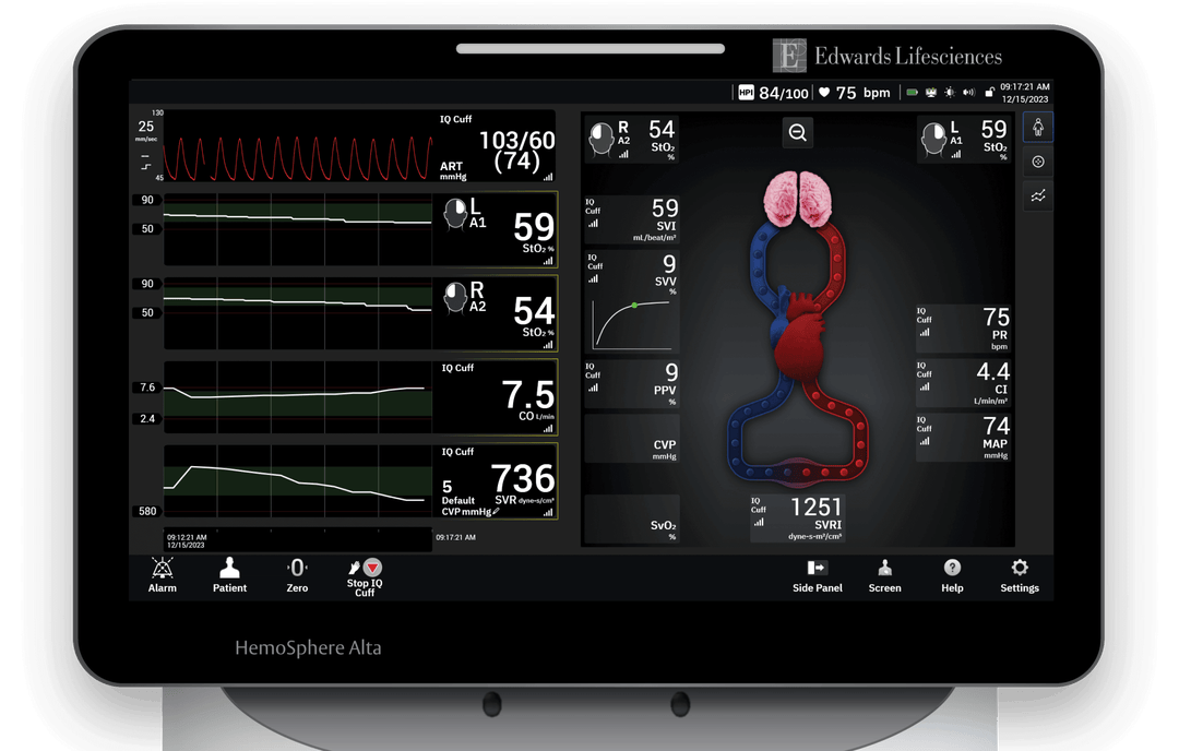 HemoSphere Alta monitor Edwards Lifesciences